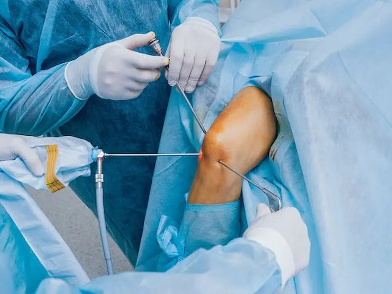 Rekomendasi Rumah Sakit Ortopedi Terbaik di Indonesia dengan Dokter Spesialis