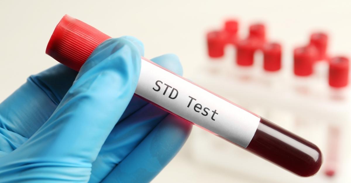 Range STD test Bali price to Detect Sexually Transmitted Infections